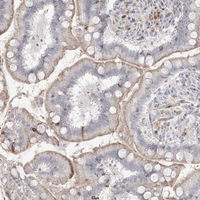 SH3BP4 Antibody in Immunohistochemistry (IHC)