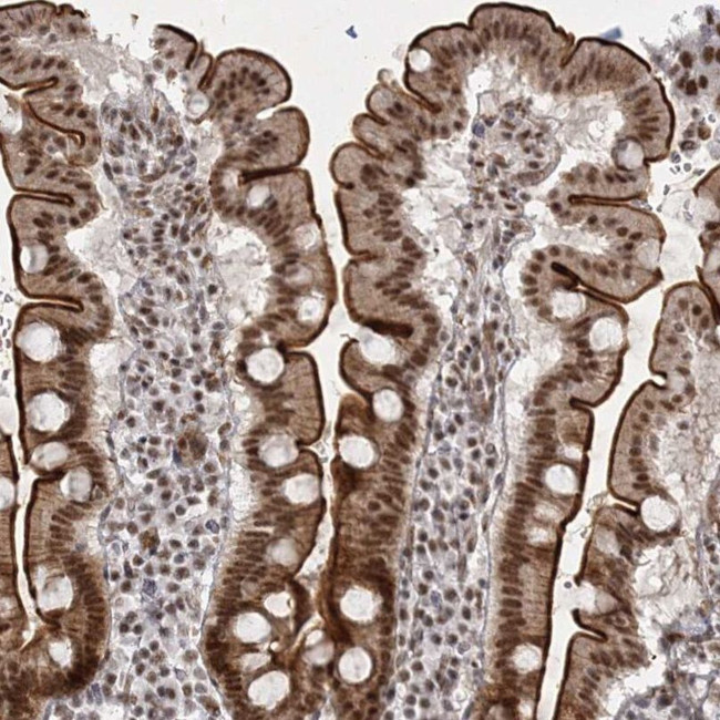 SR140 Antibody in Immunohistochemistry (IHC)