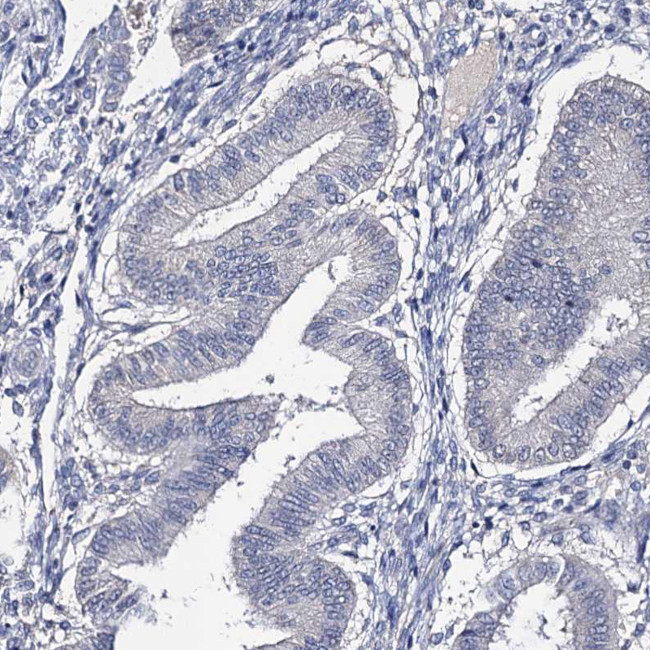 EPB41L5 Antibody in Immunohistochemistry (IHC)