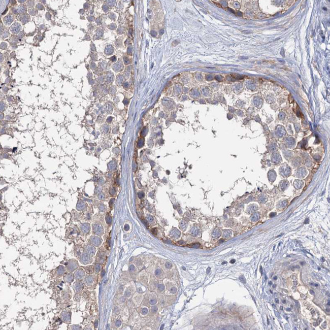 EPB41L5 Antibody in Immunohistochemistry (IHC)