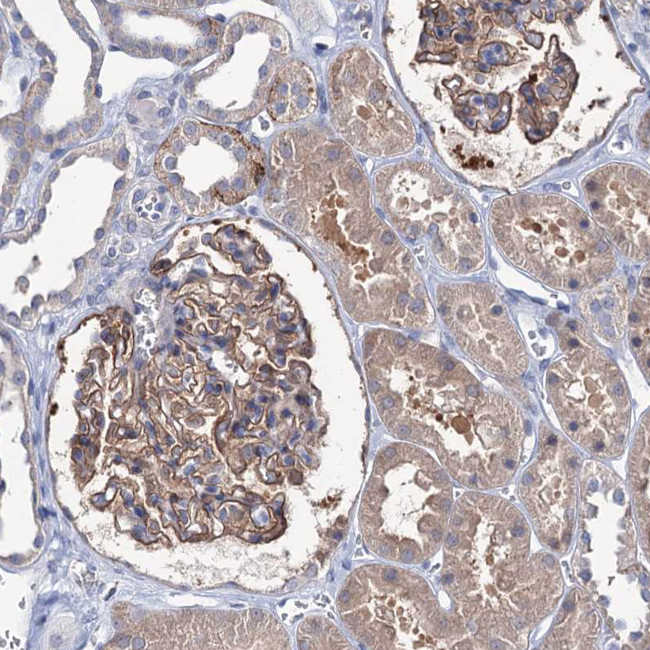 EPB41L5 Antibody in Immunohistochemistry (IHC)