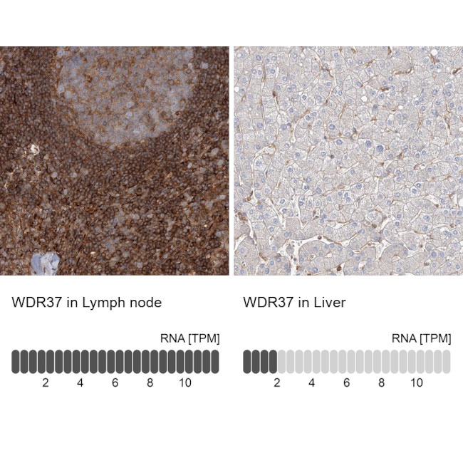 WDR37 Antibody in Immunohistochemistry (IHC)