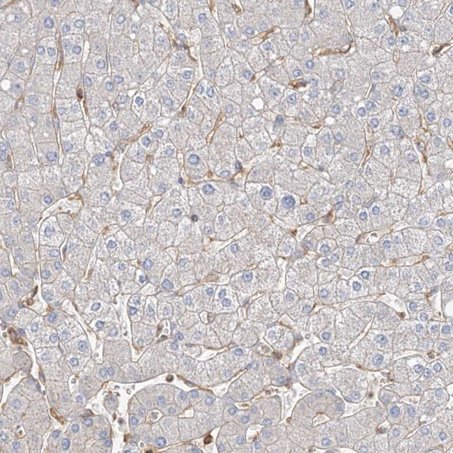 WDR37 Antibody in Immunohistochemistry (IHC)