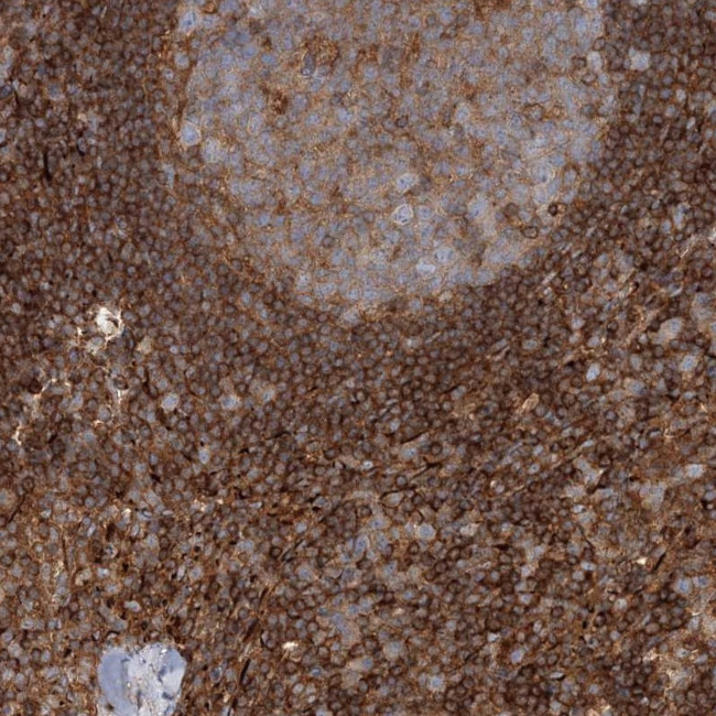 WDR37 Antibody in Immunohistochemistry (IHC)