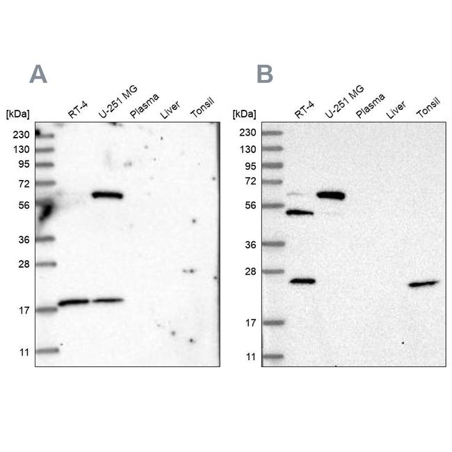 PYROXD2 Antibody in Western Blot (WB)