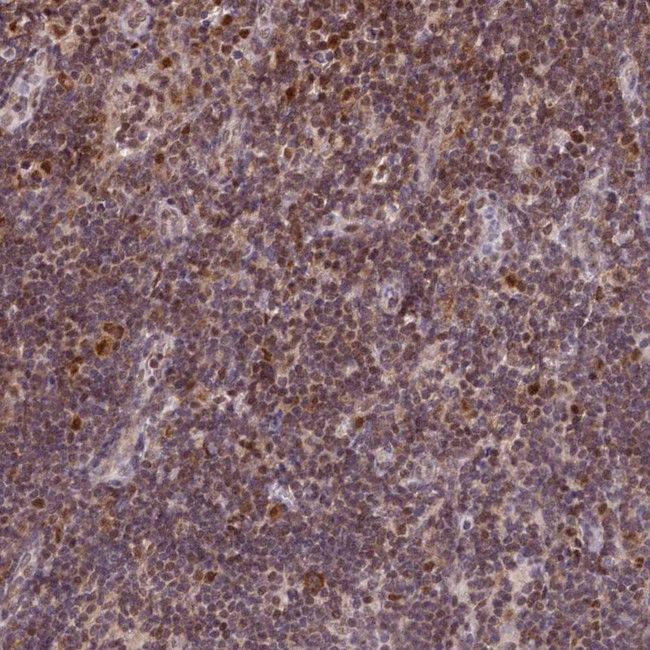 POLA2 Antibody in Immunohistochemistry (IHC)