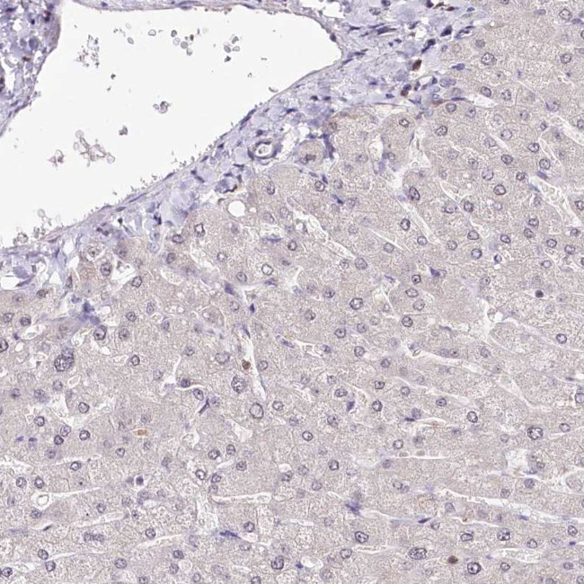 POLA2 Antibody in Immunohistochemistry (IHC)