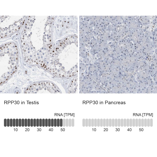 RPP30 Antibody in Immunohistochemistry (IHC)