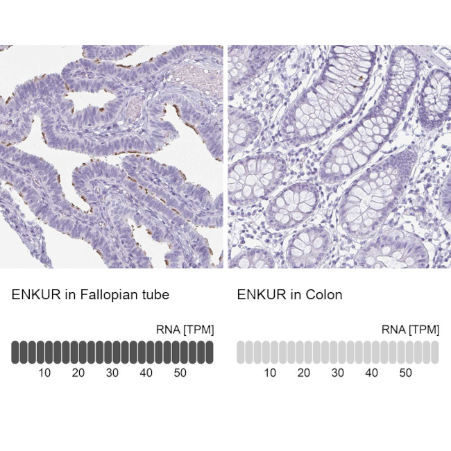 Enkurin Antibody in Immunohistochemistry (IHC)