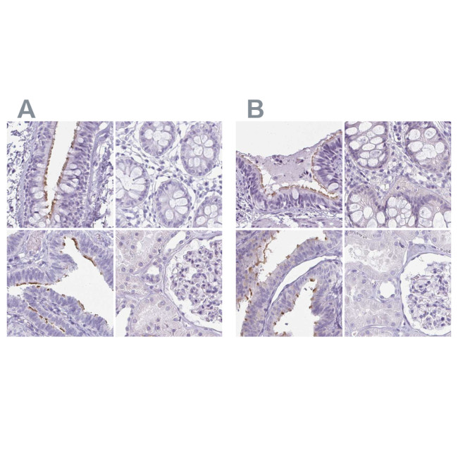 Enkurin Antibody in Immunohistochemistry (IHC)