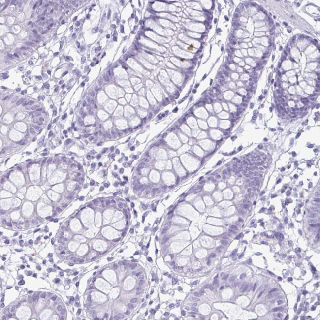 Enkurin Antibody in Immunohistochemistry (IHC)