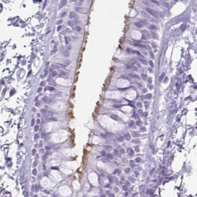 Enkurin Antibody in Immunohistochemistry (IHC)