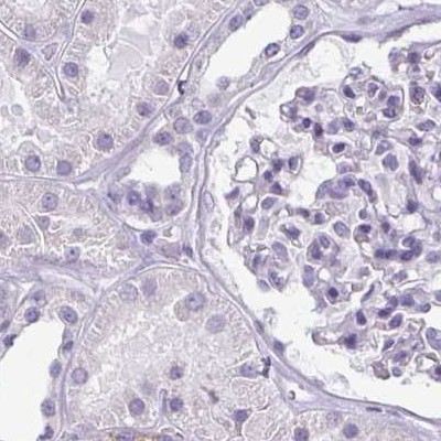 Enkurin Antibody in Immunohistochemistry (IHC)