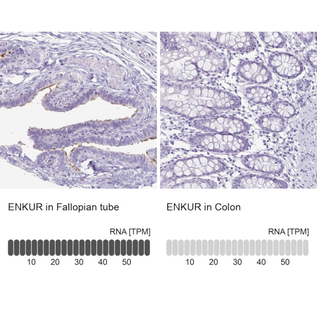 Enkurin Antibody in Immunohistochemistry (IHC)