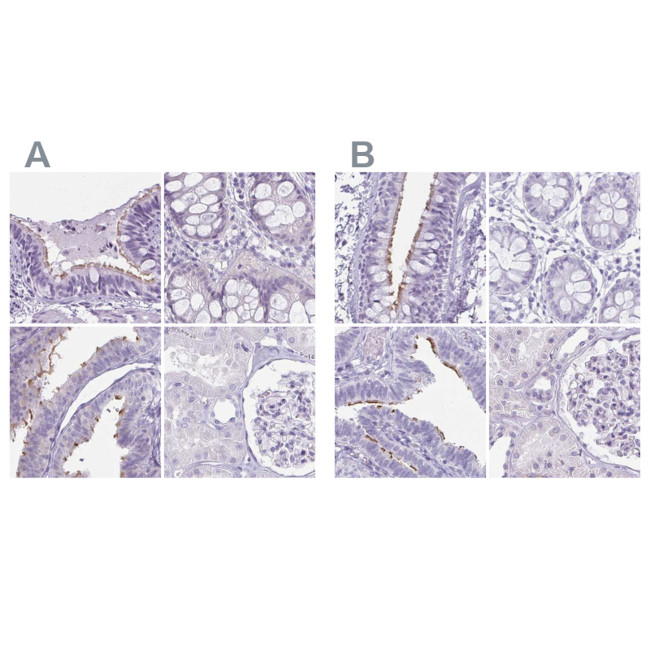 Enkurin Antibody in Immunohistochemistry (IHC)