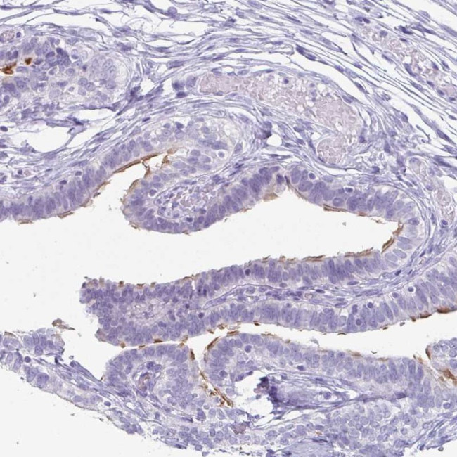 Enkurin Antibody in Immunohistochemistry (IHC)