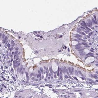 Enkurin Antibody in Immunohistochemistry (IHC)