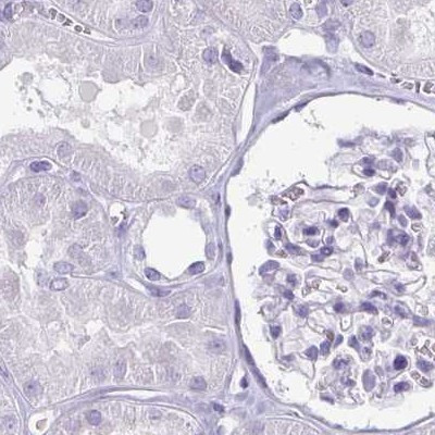 Enkurin Antibody in Immunohistochemistry (IHC)