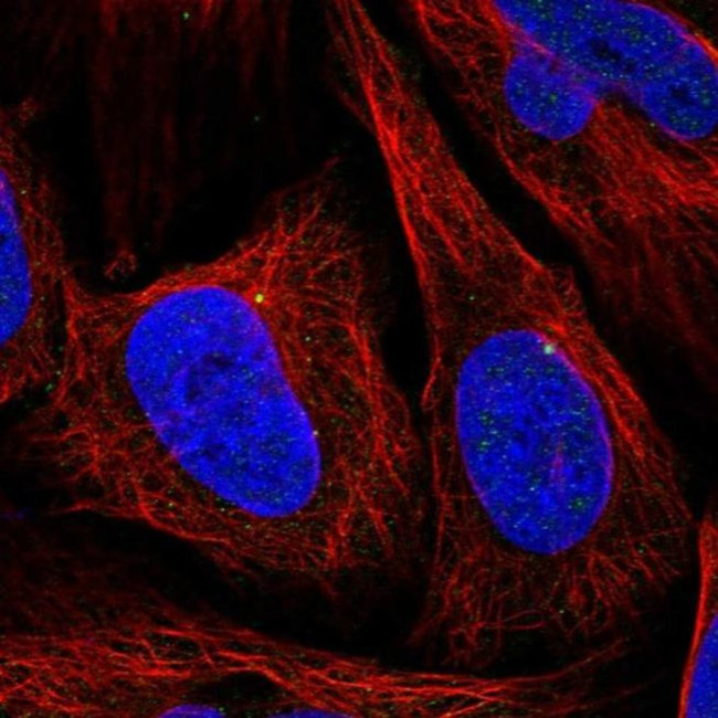 CEP164 Antibody in Immunocytochemistry (ICC/IF)