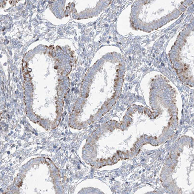 CEP164 Antibody in Immunohistochemistry (IHC)