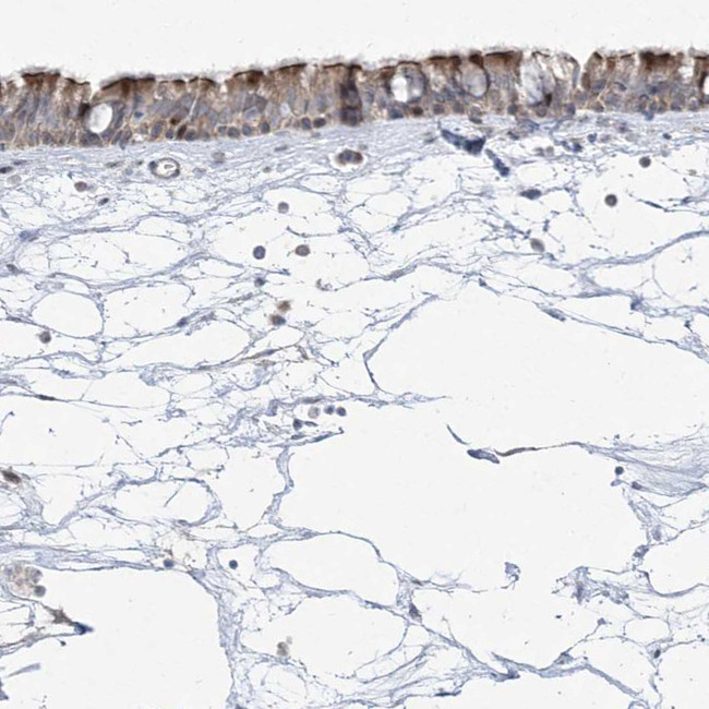 CEP164 Antibody in Immunohistochemistry (IHC)