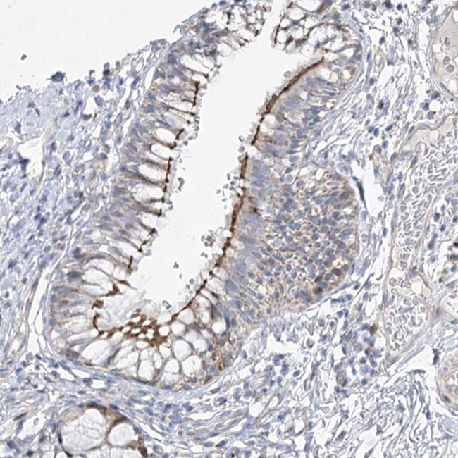 CEP164 Antibody in Immunohistochemistry (IHC)