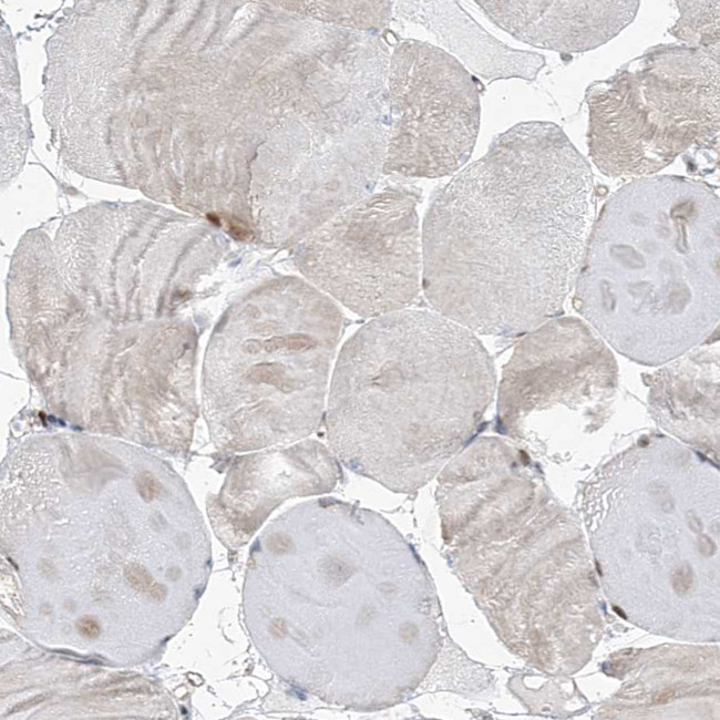 CEP164 Antibody in Immunohistochemistry (IHC)