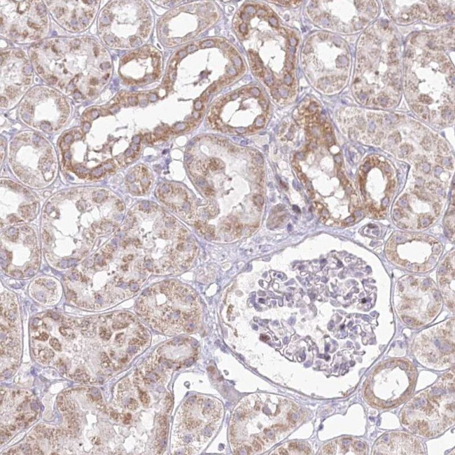 CEP164 Antibody in Immunohistochemistry (IHC)