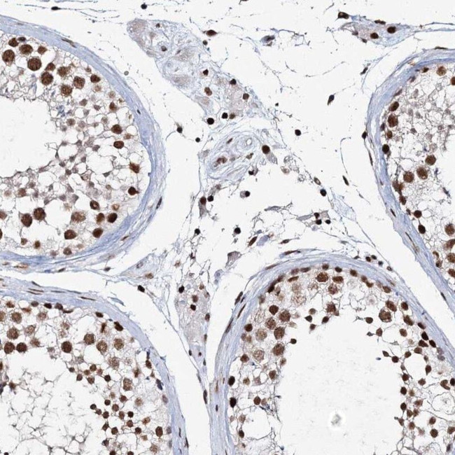 QRICH1 Antibody in Immunohistochemistry (IHC)