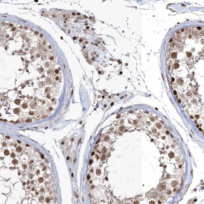 QRICH1 Antibody in Immunohistochemistry (IHC)