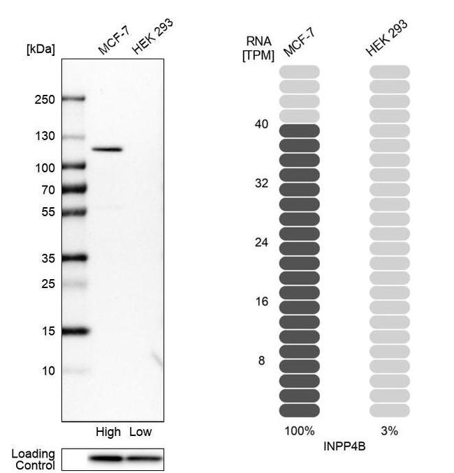 INPP4B Antibody in Western Blot (WB)