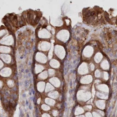 FCHO2 Antibody in Immunohistochemistry (IHC)