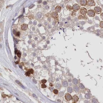 FCHO2 Antibody in Immunohistochemistry (IHC)