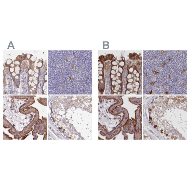 FCHO2 Antibody in Immunohistochemistry (IHC)