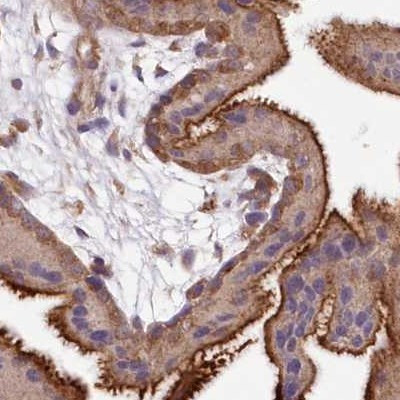 FCHO2 Antibody in Immunohistochemistry (IHC)