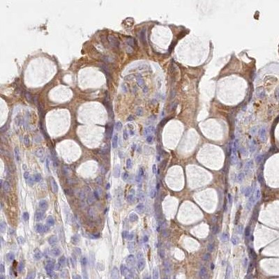 FCHO2 Antibody in Immunohistochemistry (IHC)