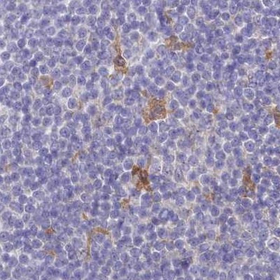 FCHO2 Antibody in Immunohistochemistry (IHC)