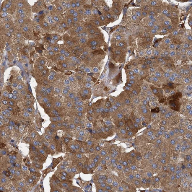 BCS1L Antibody in Immunohistochemistry (IHC)