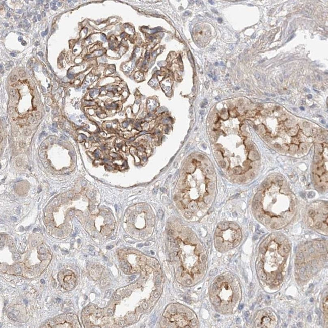 MAT2B Antibody in Immunohistochemistry (IHC)