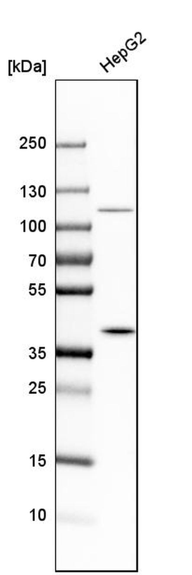 MAT2B Antibody in Western Blot (WB)