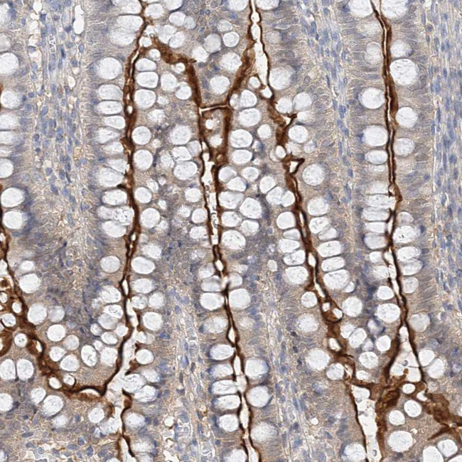 MAT2B Antibody in Immunohistochemistry (IHC)