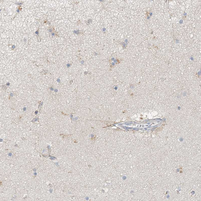 MAT2B Antibody in Immunohistochemistry (IHC)