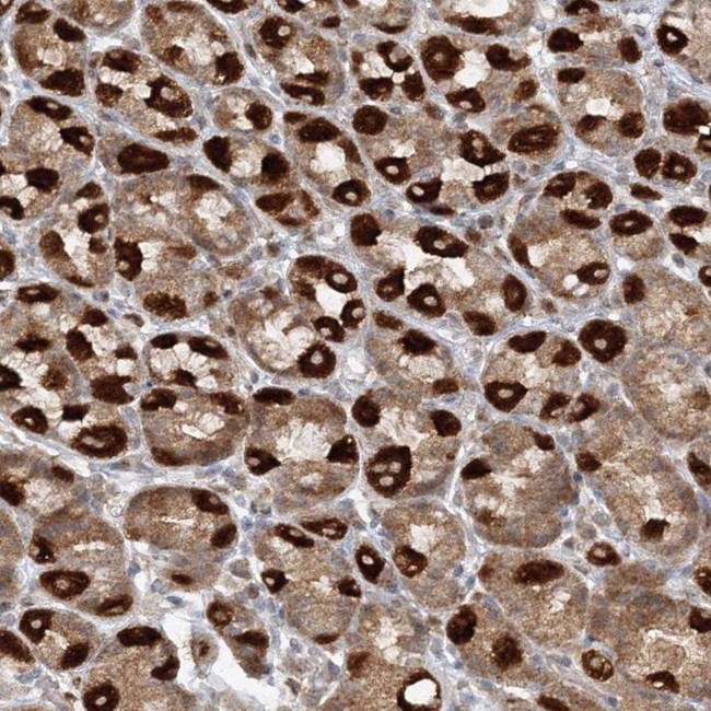 RAB11FIP2 Antibody in Immunohistochemistry (IHC)