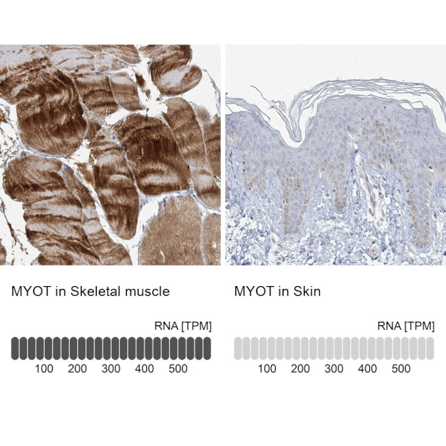 Myotilin Antibody in Immunohistochemistry (IHC)