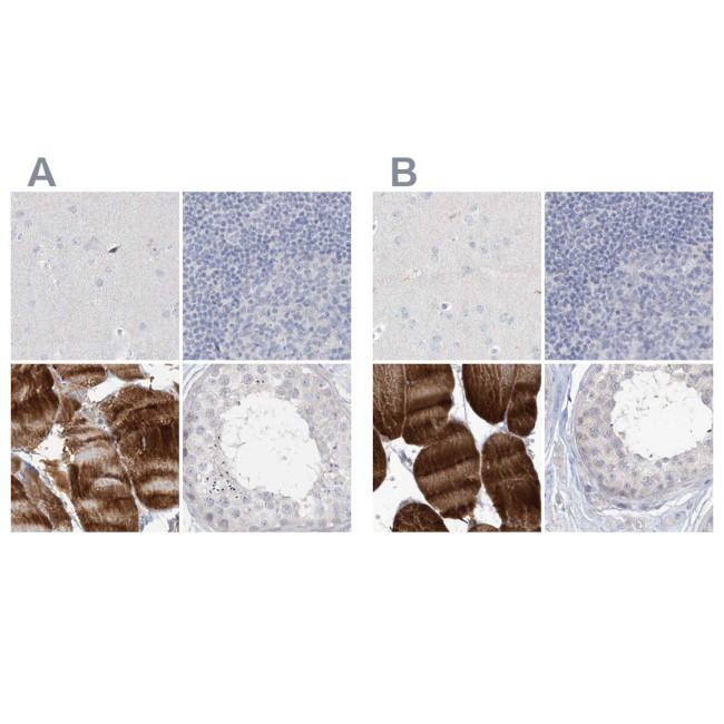 Myotilin Antibody in Immunohistochemistry (IHC)