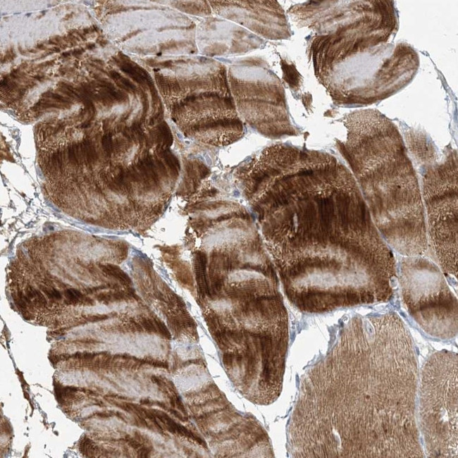 Myotilin Antibody in Immunohistochemistry (IHC)