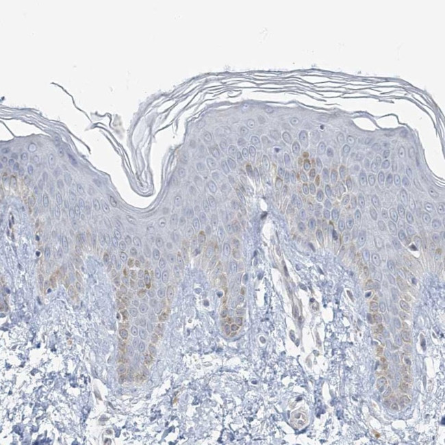 Myotilin Antibody in Immunohistochemistry (IHC)