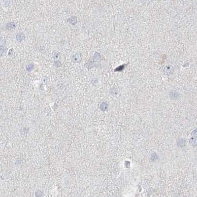 Myotilin Antibody in Immunohistochemistry (IHC)