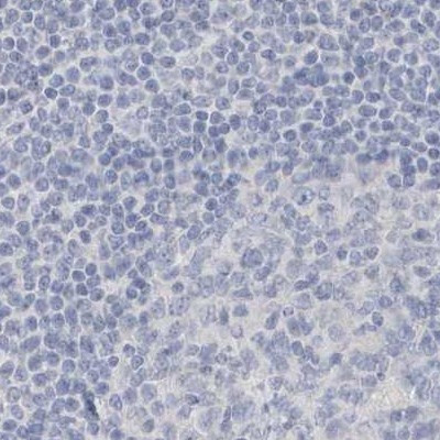 Myotilin Antibody in Immunohistochemistry (IHC)