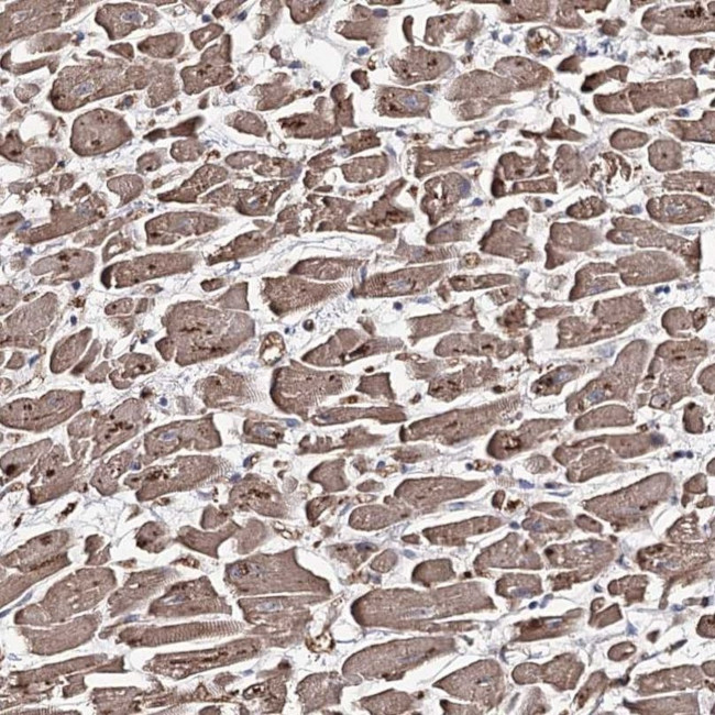 GBF1 Antibody in Immunohistochemistry (IHC)